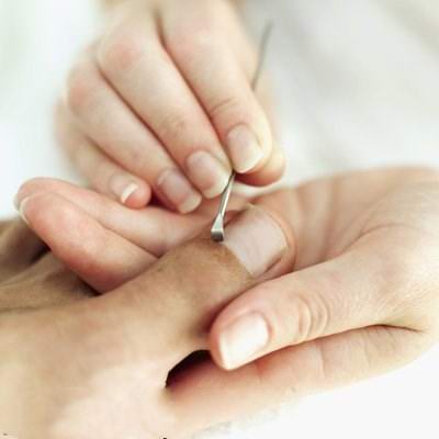 爱足康修脚加盟培训|甲沟炎是如何引起的