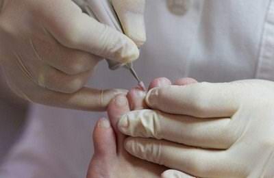 洛阳爱足康修脚堂|如何治疗甲沟炎